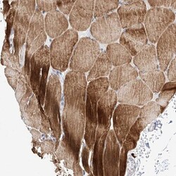 RECQL5 Antibody, Novus Biologicals 25 &mu;L | Buy Online | Novus Biologicals | Fisher Scientific