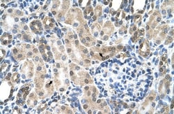 Reduced Folate Carrier/SLC19A1 Antibody, Novus Biologicals 0.1mg; Unlabeled:Antibodies,