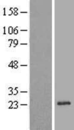 Novus Biologicals&trade;&nbsp;REEP1 Overexpression Lysate