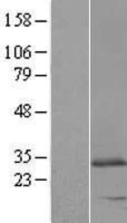 Novus Biologicals™ REEP2 Overexpression Lysate
