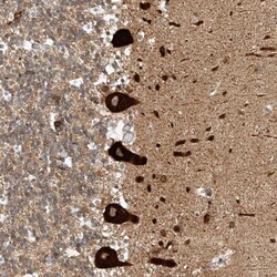 REEP2 Antibody, Novus Biologicals:Antibodies:Primary Antibodies