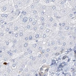 REEP2 Antibody, Novus Biologicals:Antibodies:Primary Antibodies