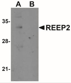 REEP2 Antibody - BSA Free, Novus Biologicals 0.1mg; Unlabeled:Antibodies,