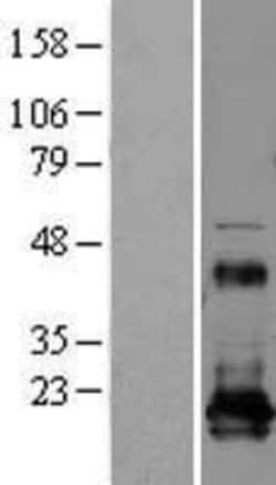 Novus Biologicals™ REEP5 Overexpression Lysate