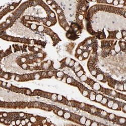 HAAO Antibody, Novus Biologicals:Antibodies:Primary Antibodies