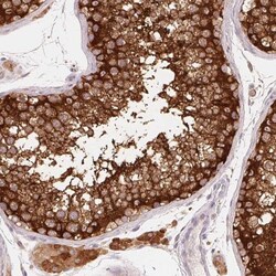 REEP6 Antibody, Novus Biologicals:Antibodies:Primary Antibodies