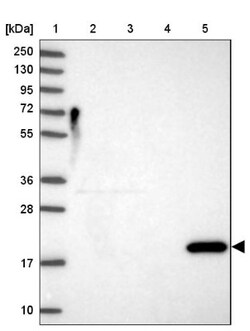 Reg1A Antibody, Novus Biologicals:Antibodies:Primary Antibodies