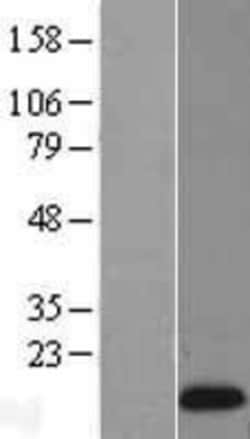 Novus Biologicals™ Reg1A Overexpression Lysate