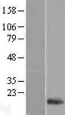 Novus Biologicals&trade;&nbsp;Reg1B Overexpression Lysate