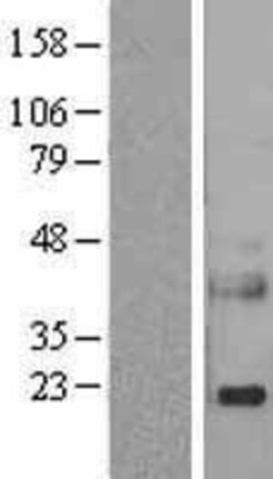 Novus Biologicals&trade;&nbsp;Reg3A Overexpression Lysate