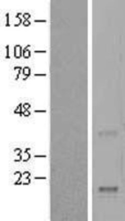 Novus Biologicals™ Reg4 Overexpression Lysate