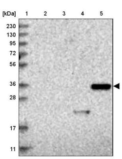 Regucalcin Antibody, Novus Biologicals:Antibodies:Primary Antibodies