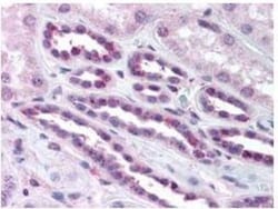 RelA/NFkB p65, p Ser276 Antibody, Novus Biologicals 0.1mL; Unlabeled:Antibodies,