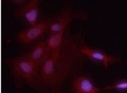 RelA/NFkB p65, p Ser536 Antibody, Novus Biologicals 25 &mu;L; Unconjugated:Antibodies,