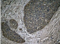 RelA/NFkB p65, p Ser536 Antibody, Novus Biologicals 25 &mu;L; Unconjugated:Antibodies,