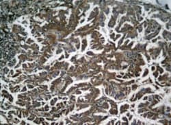 RelA/NFkB p65, p Ser536 Antibody, Novus Biologicals 25 &mu;L; Unconjugated:Antibodies,