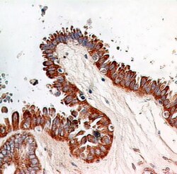 RelA/NFkB p65 Antibody (112A1021) - BSA Free, Novus Biologicals 0.1mg;