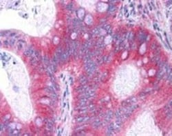 RelA/NFkB p65 Antibody (27F9.G4), Novus Biologicals 0.1mg; Unlabeled:Antibodies,