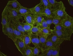 RelA/NFkB p65 Antibody, Novus Biologicals 100 &mu;L | Buy Online | Novus Biologicals | Fisher Scientific