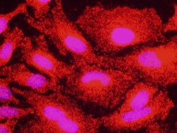 RelA/NFkB p65 Antibody, Novus Biologicals 100 &mu;L | Buy Online | Novus Biologicals | Fisher Scientific