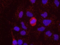 RelA/NFkB p65 Antibody, Novus Biologicals 100 &mu;L | Buy Online | Novus Biologicals | Fisher Scientific