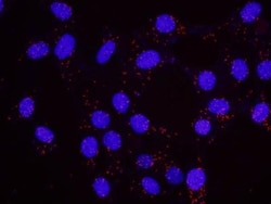 RelA/NFkB p65 Antibody, Novus Biologicals 100 &mu;L | Buy Online | Novus Biologicals | Fisher Scientific