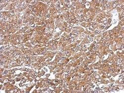 RelB Antibody, Novus Biologicals 0.1mL; Unlabeled:Antibodies, Polyclonal