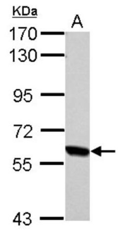 RelB Antibody, Novus Biologicals 0.1mL; Unlabeled:Antibodies, Polyclonal