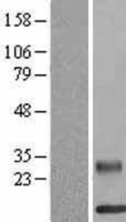 Novus Biologicals&trade;&nbsp;RELM beta Overexpression Lysate