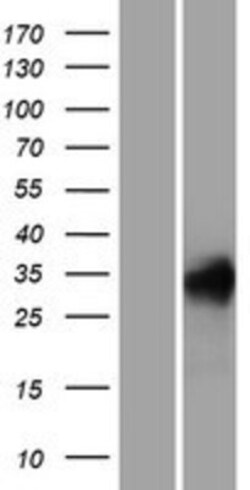 Novus Biologicals&trade;&nbsp;REM1 Overexpression Lysate