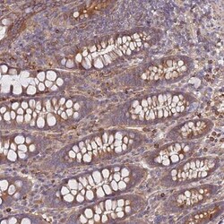 REM1 Antibody, Novus Biologicals 0.1mL; Unlabeled:Antibodies, Polyclonal