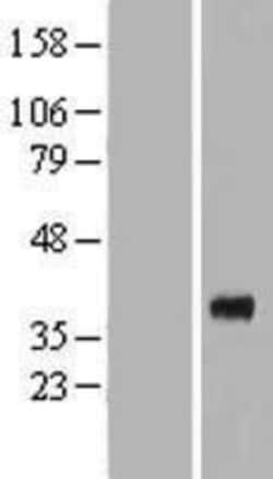 Novus Biologicals&trade;&nbsp;Renalase Overexpression Lysate