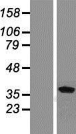Novus Biologicals™ Renalase Overexpression Lysate