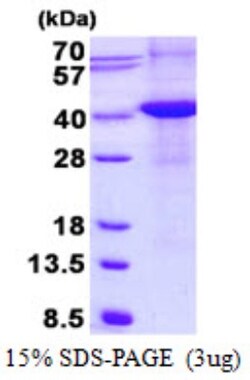 Novus Biologicals&trade;&nbsp;Recombinant Human Renalase His Protein