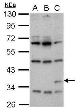 Renilla Luciferase Antibody, Novus Biologicals 0.1mL:Antibodies, Polyclonal
