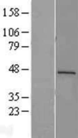 Novus Biologicals&trade;&nbsp;Renin Overexpression Lysate