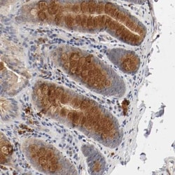 Renin Antibody, Novus Biologicals:Antibodies:Primary Antibodies