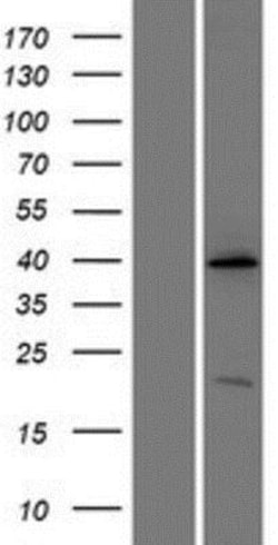 Novus Biologicals&trade;&nbsp;Renin R Overexpression Lysate