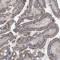 RENT1/UPF1/hUPF1 Antibody, Novus Biologicals 0.1mL; Unlabeled:Antibodies,