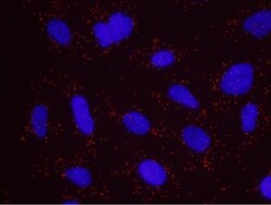 RENT1/UPF1/hUPF1 Antibody, Novus Biologicals 100 &mu;L | Buy Online | Novus Biologicals | Fisher Scientific