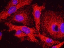 RENT1/UPF1/hUPF1 Antibody, Novus Biologicals 100 &mu;L | Buy Online | Novus Biologicals | Fisher Scientific