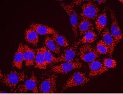 RENT1/UPF1/hUPF1 Antibody, Novus Biologicals 100 &mu;L | Buy Online | Novus Biologicals | Fisher Scientific