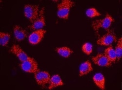 RENT1/UPF1/hUPF1 Antibody, Novus Biologicals 100 &mu;L | Buy Online | Novus Biologicals | Fisher Scientific