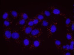 RENT1/UPF1/hUPF1 Antibody, Novus Biologicals 100 &mu;L | Buy Online | Novus Biologicals | Fisher Scientific