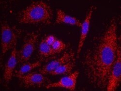 RENT1/UPF1/hUPF1 Antibody, Novus Biologicals 100 &mu;L | Buy Online | Novus Biologicals | Fisher Scientific