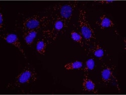 RENT1/UPF1/hUPF1 Antibody, Novus Biologicals 100 &mu;L | Buy Online | Novus Biologicals | Fisher Scientific