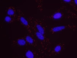 RENT1/UPF1/hUPF1 Antibody, Novus Biologicals 100 &mu;L | Buy Online | Novus Biologicals | Fisher Scientific