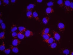 RENT1/UPF1/hUPF1 Antibody, Novus Biologicals 100 &mu;L | Buy Online | Novus Biologicals | Fisher Scientific