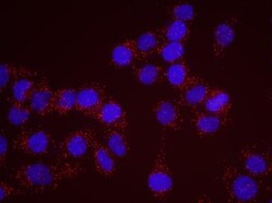 RENT1/UPF1/hUPF1 Antibody, Novus Biologicals 100 &mu;L | Buy Online | Novus Biologicals | Fisher Scientific