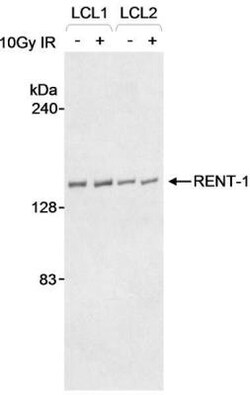 RENT1/UPF1/hUPF1 Antibody, Novus Biologicals 0.1mg; Unlabeled:Antibodies,